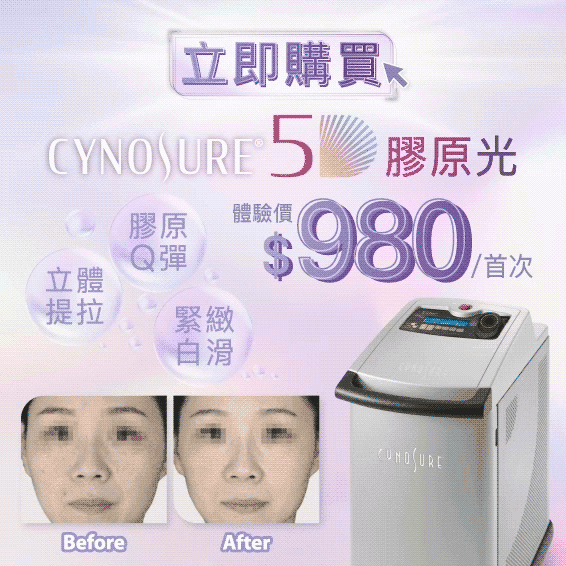Cynosure® Elite 5D胶原光焕肤| MÍOGGÍ MediCentre｜医学轻龄专家